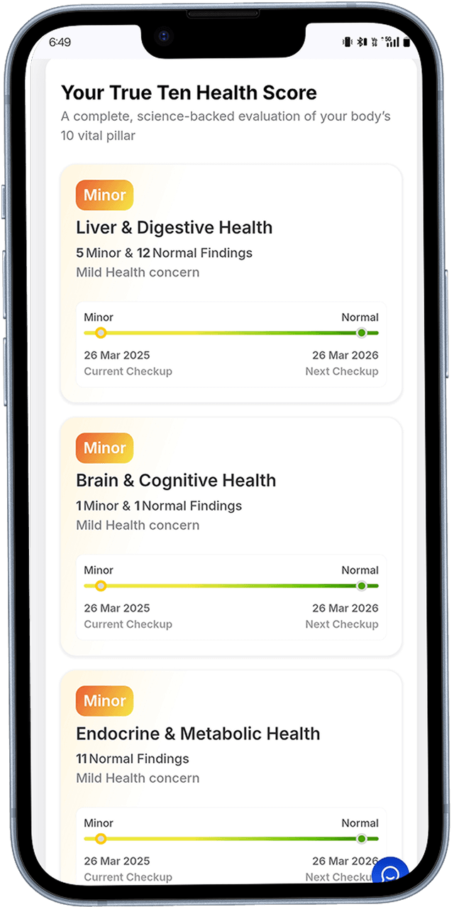 Organ wise Risk score